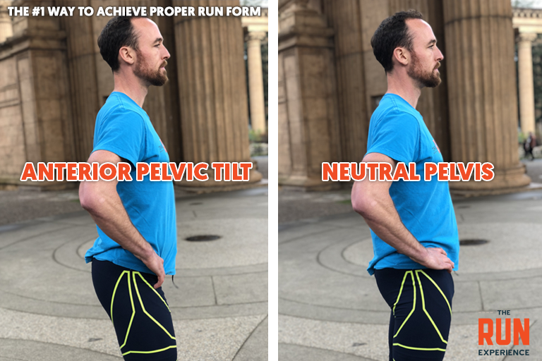 Comparison of pelvic positions